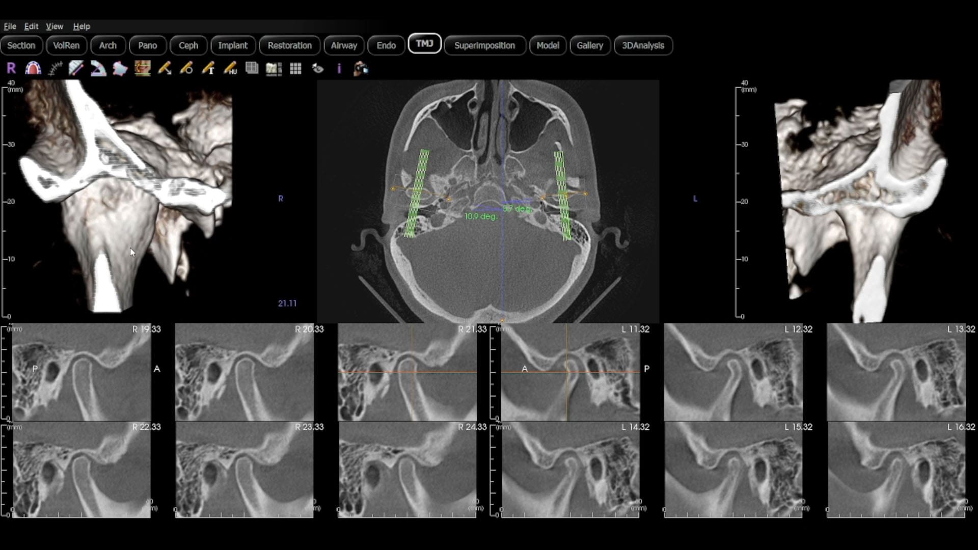 patient 3D imaging results Advanced 3D dental imaging technology for precise treatment planning