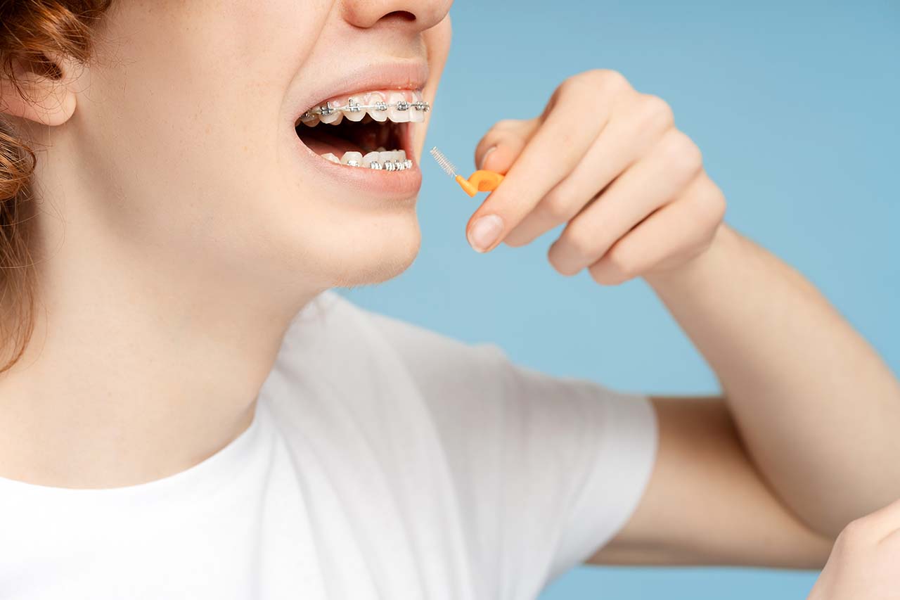 teen girl with braces practicing good oral hygiene Teen girl with braces brushing her teeth and flossing, demonstrating proper oral hygiene for orthodontic patients.