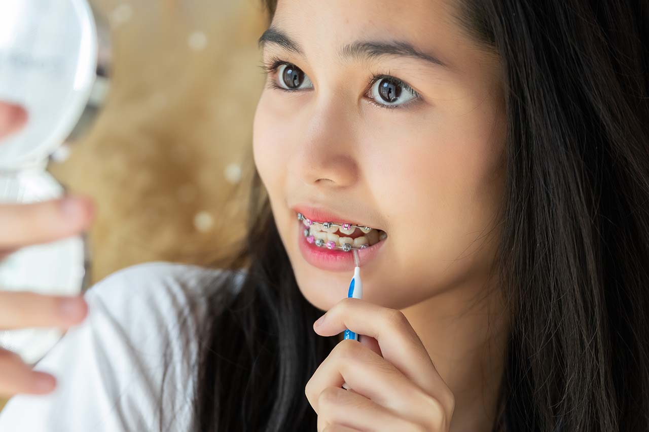 teenage girl using brush to carefully clean her teeth and braces Dental care for braces, young woman brushing teeth with orthodontic appliances