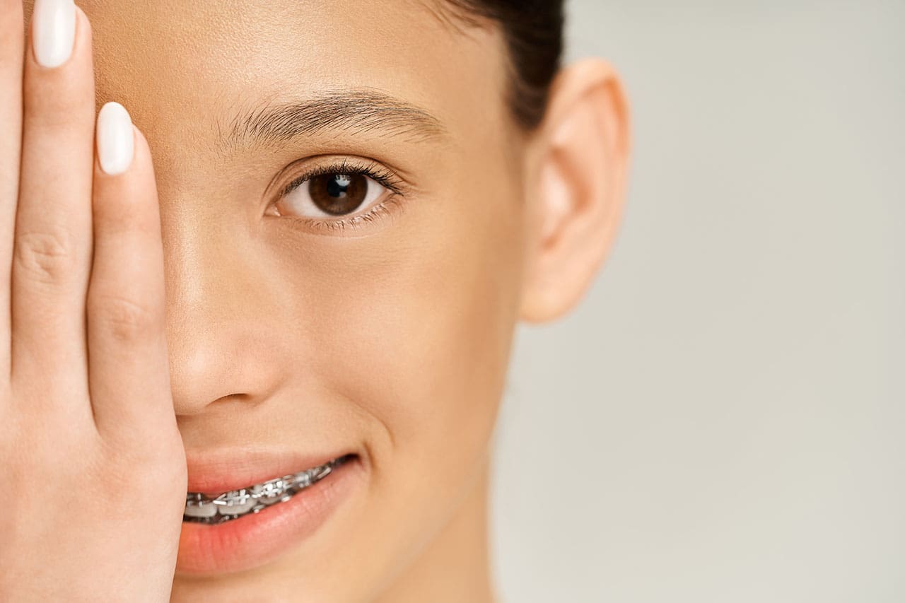 young woman in braces covering one eye with her hand Young woman experiencing orthodontic discomfort, covering eye, dental emergency