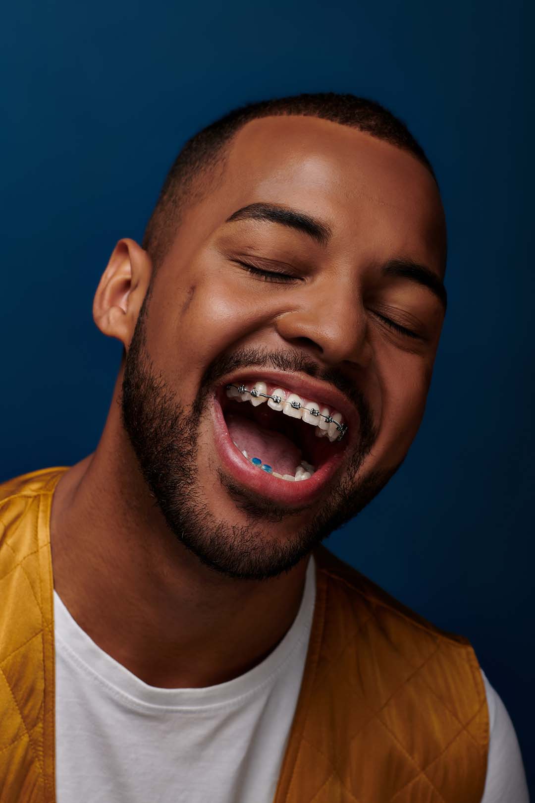 cheerful man with beard and braces laughing Ferri Orthodontics treats all ages, including adults
