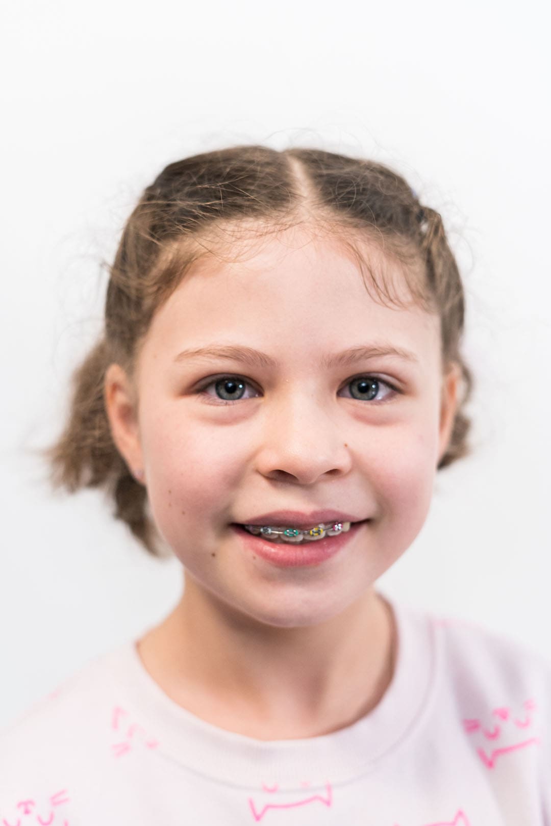 little girl with rainbow braces Young girl smiles and shows off her rainbow braces