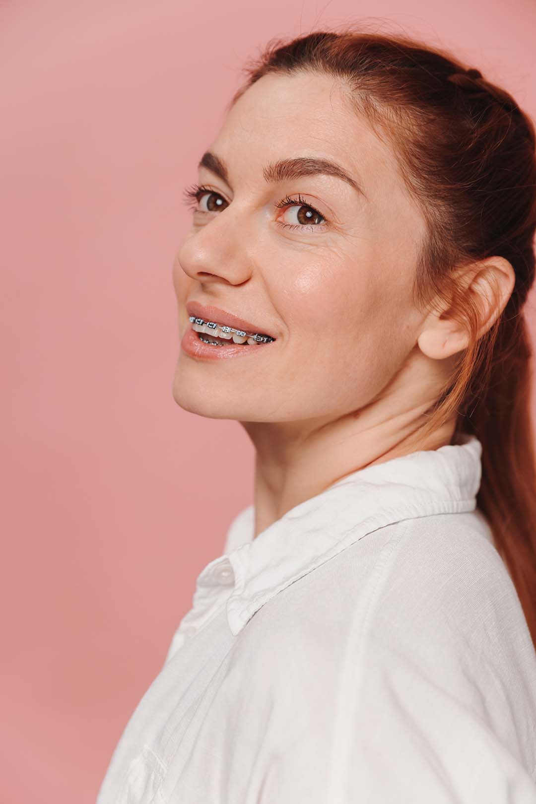 A modern woman in braces smiles Ferri Orthodontics treats all ages, including adults