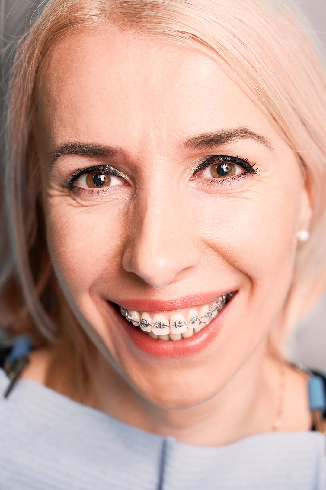 senior woman in braces smiling at a checkup Ferri Orthodontics treats all ages, including seniors